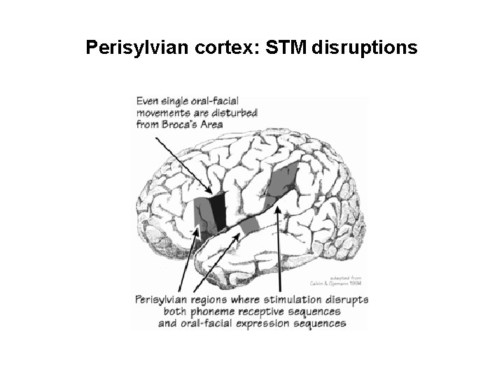 Perisylvian cortex: STM disruptions 