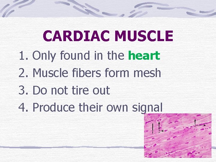 CARDIAC MUSCLE 1. 2. 3. 4. Only found in the heart Muscle fibers form