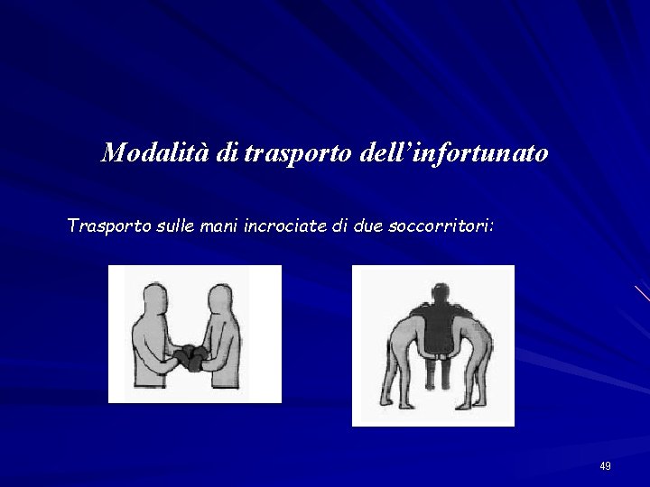 Modalità di trasporto dell’infortunato Trasporto sulle mani incrociate di due soccorritori: 49 