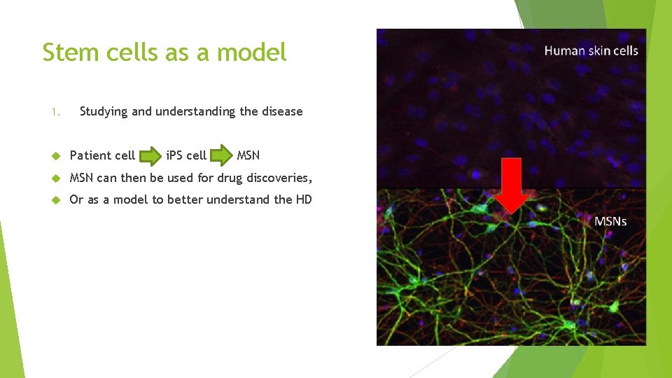 Stem cells as a model 1. Studying and understanding the disease Patient cell i.