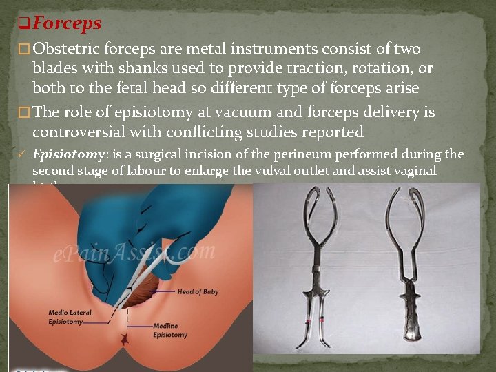q. Forceps � Obstetric forceps are metal instruments consist of two blades with shanks
