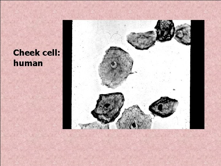 Cheek cell: human 