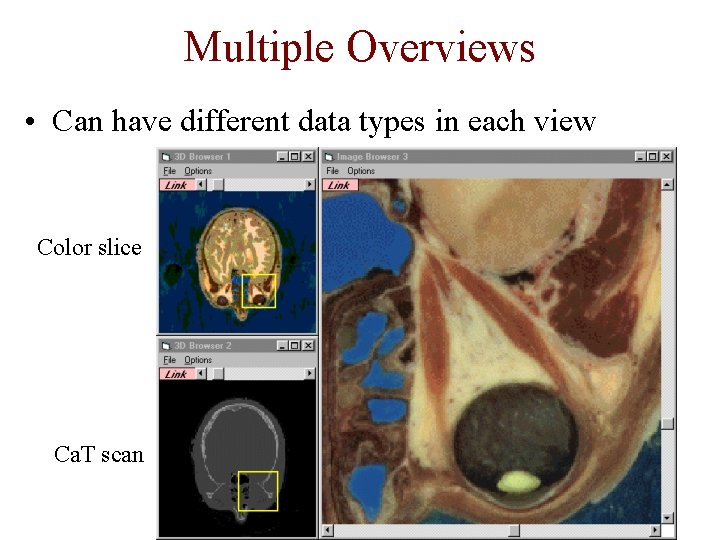 Multiple Overviews • Can have different data types in each view Color slice Ca.