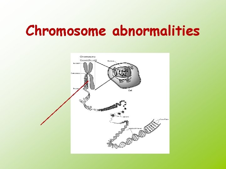 Chromosome abnormalities 