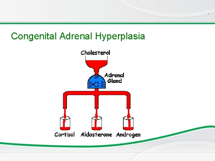 . Congenital Adrenal Hyperplasia 