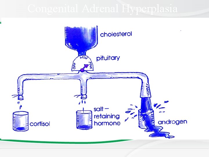 Congenital Adrenal Hyperplasia 