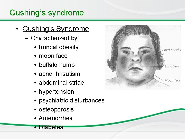 Cushing’s syndrome • Cushing’s Syndrome – Characterized by: • truncal obesity • moon face