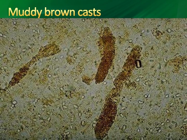 Muddy brown casts Muddy brown casts
