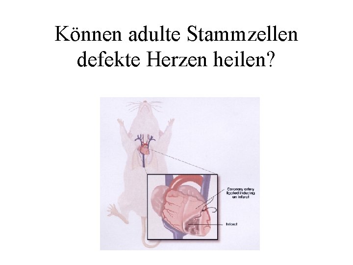 Können adulte Stammzellen defekte Herzen heilen? 