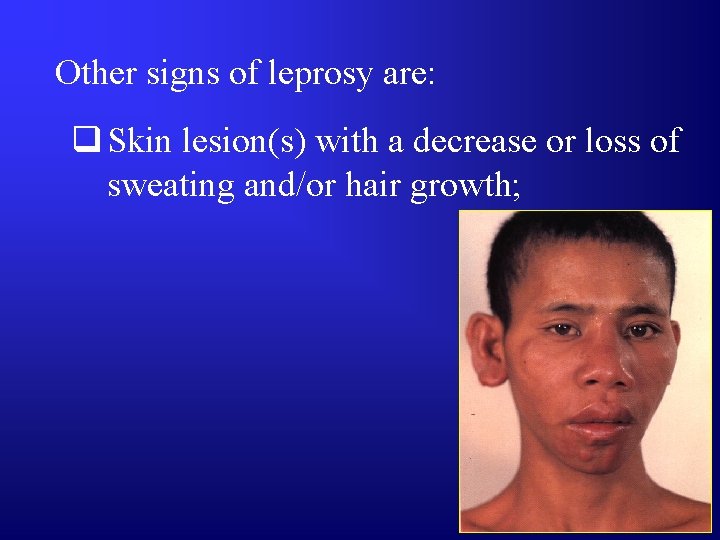 Other signs of leprosy are: q Skin lesion(s) with a decrease or loss of