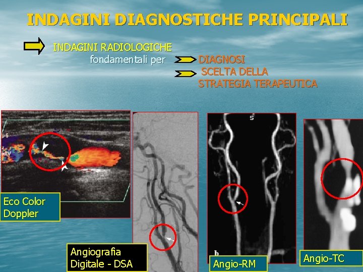 INDAGINI DIAGNOSTICHE PRINCIPALI INDAGINI RADIOLOGICHE fondamentali per DIAGNOSI SCELTA DELLA STRATEGIA TERAPEUTICA Eco Color