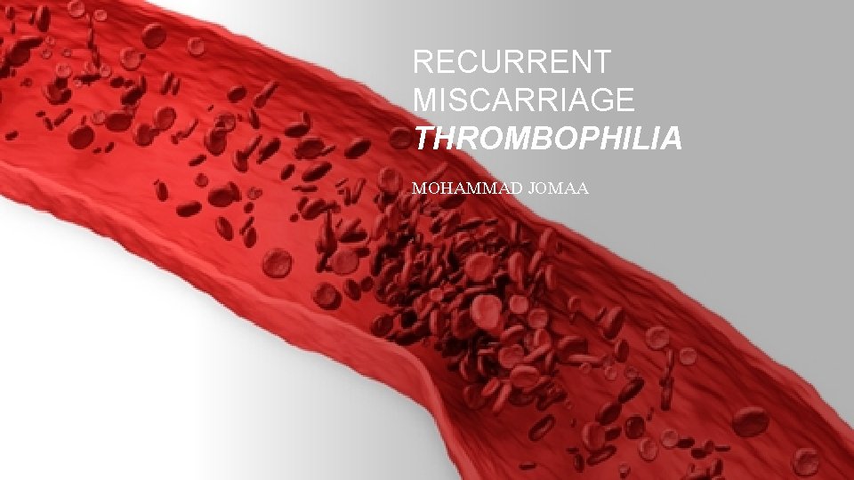 RECURRENT MISCARRIAGE THROMBOPHILIA MOHAMMAD JOMAA 