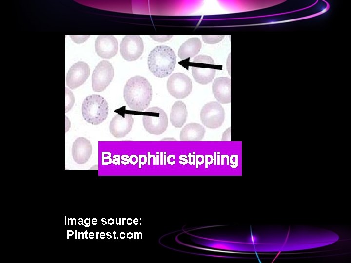 Basophilic stippling Image source: Pinterest. com 