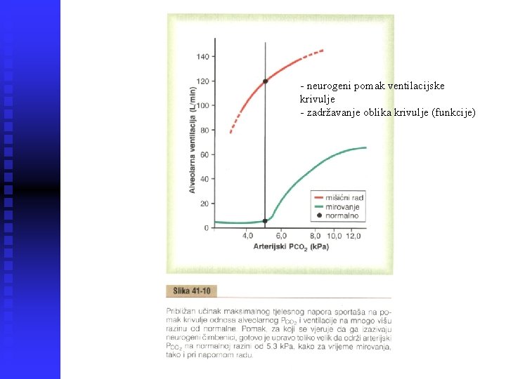 - neurogeni pomak ventilacijske krivulje - zadržavanje oblika krivulje (funkcije) 