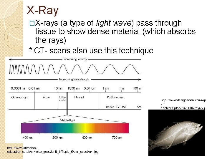 X-Ray �X-rays (a type of light wave) pass through tissue to show dense material X-Ray �X-rays (a type of light wave) pass through tissue to show dense material