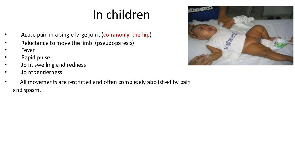 In children • • Acute pain in a single large joint (commonly the hip)