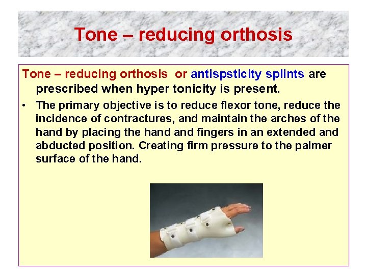 Tone – reducing orthosis or antispsticity splints are prescribed when hyper tonicity is present.