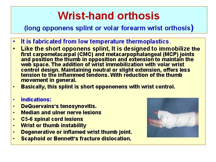 Wrist-hand orthosis (long opponens splint or volar forearm wrist orthosis) • It is fabricated