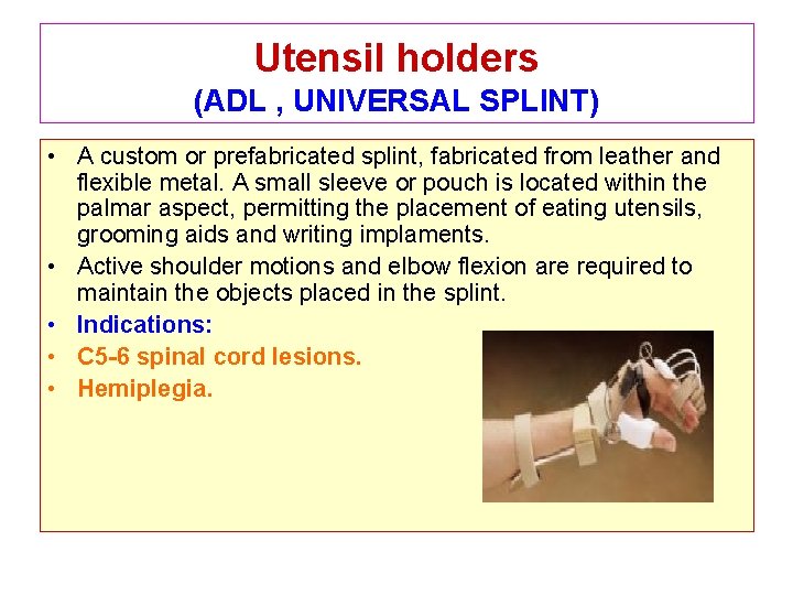 Utensil holders (ADL , UNIVERSAL SPLINT) • A custom or prefabricated splint, fabricated from
