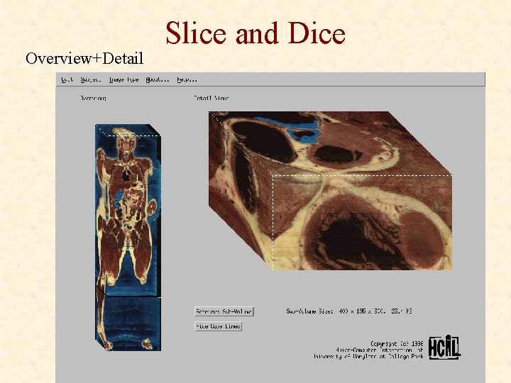 Overview+Detail Slice and Dice 