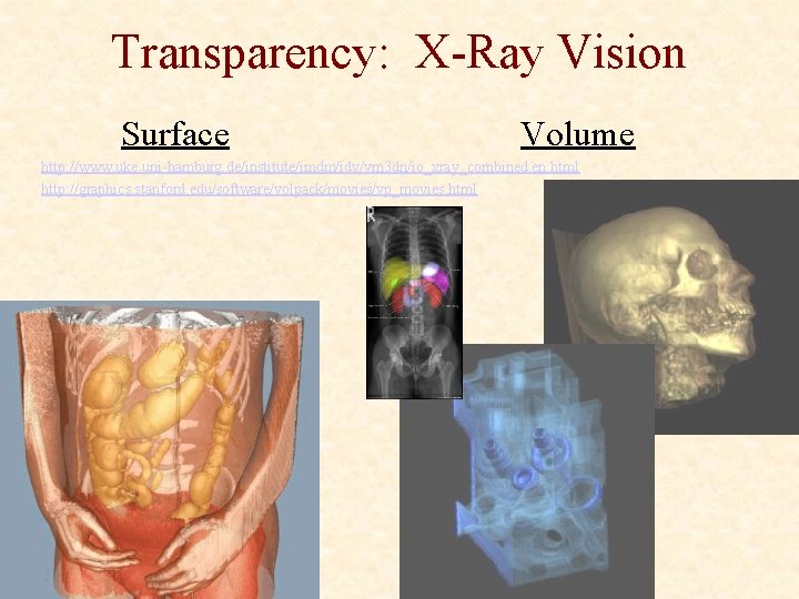 Transparency: X-Ray Vision Surface Volume http: //www. uke. uni-hamburg. de/institute/imdm/idv/vm 3 dn/io_xray_combined. en. html