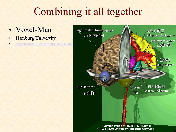 Combining it all together • Voxel-Man • Hamburg University • http: //www. uke. uni-hamburg.
