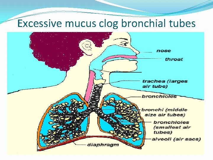 Excessive mucus clog bronchial tubes 