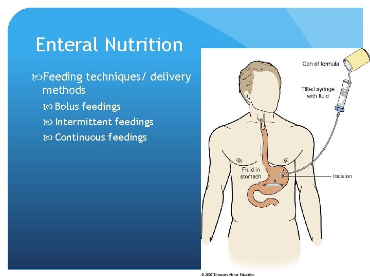 Enteral Nutrition Feeding techniques/ delivery methods Bolus feedings Intermittent feedings Continuous feedings © 2007