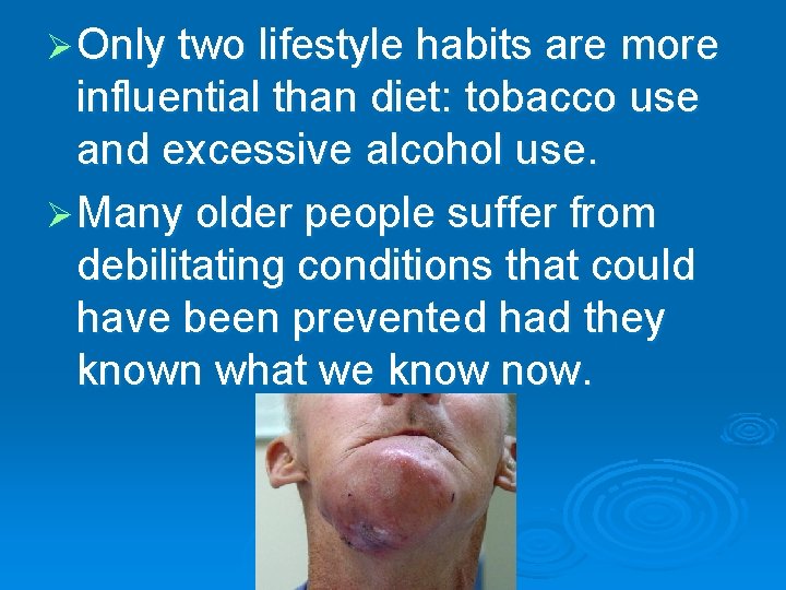 Ø Only two lifestyle habits are more influential than diet: tobacco use and excessive