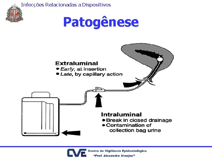 Infecções Relacionadas a Dispositivos Patogênese 