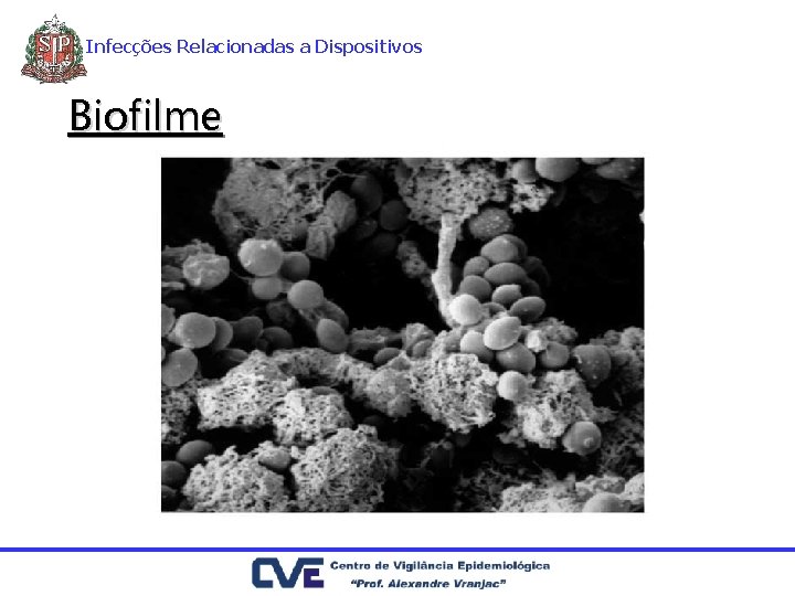 Infecções Relacionadas a Dispositivos Biofilme 