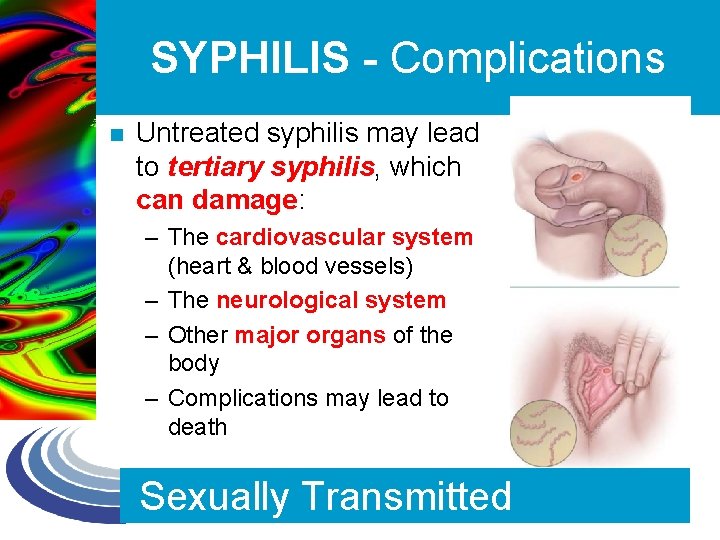 SYPHILIS - Complications n Untreated syphilis may lead to tertiary syphilis, which can damage: