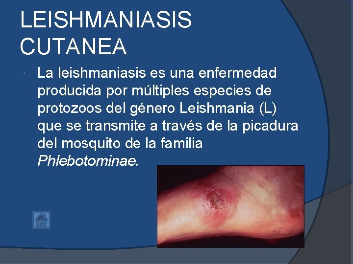 LEISHMANIASIS CUTANEA La leishmaniasis es una enfermedad producida por múltiples especies de protozoos del LEISHMANIASIS CUTANEA La leishmaniasis es una enfermedad producida por múltiples especies de protozoos del