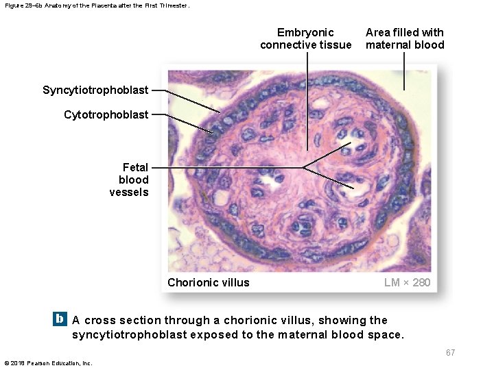 Figure 29– 6 b Anatomy of the Placenta after the First Trimester. Embryonic connective