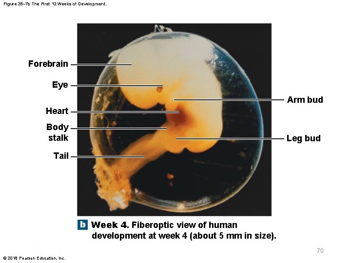 Figure 29– 7 b The First 12 Weeks of Development. Forebrain Eye Arm bud