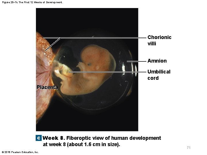 Figure 29– 7 c The First 12 Weeks of Development. Chorionic villi Amnion Umbilical