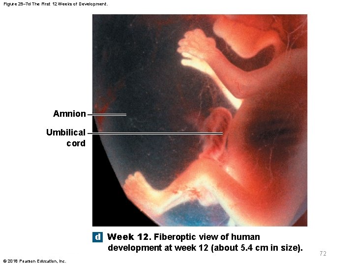 Figure 29– 7 d The First 12 Weeks of Development. Amnion Umbilical cord d