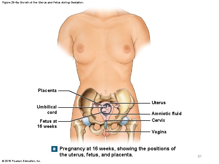 Figure 29– 9 a Growth of the Uterus and Fetus during Gestation. Placenta Umbilical