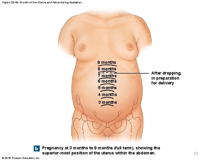 Figure 29– 9 b Growth of the Uterus and Fetus during Gestation. 9 months