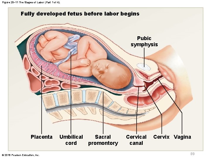 Figure 29– 11 The Stages of Labor (Part 1 of 4). Fully developed fetus