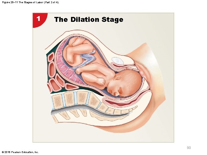 Figure 29– 11 The Stages of Labor (Part 2 of 4). 1 The Dilation