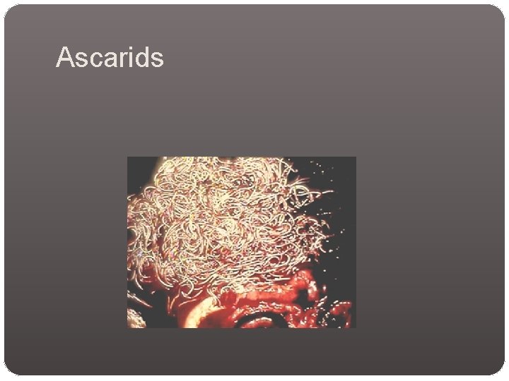 Ascarids Ascarids