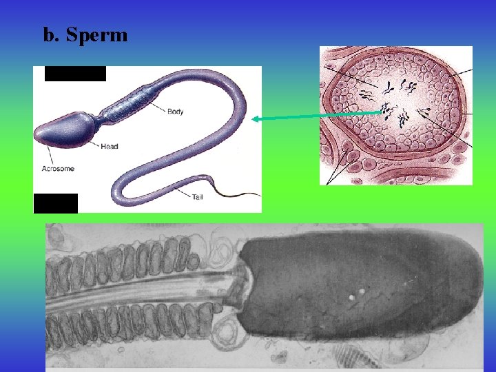 b. Sperm 