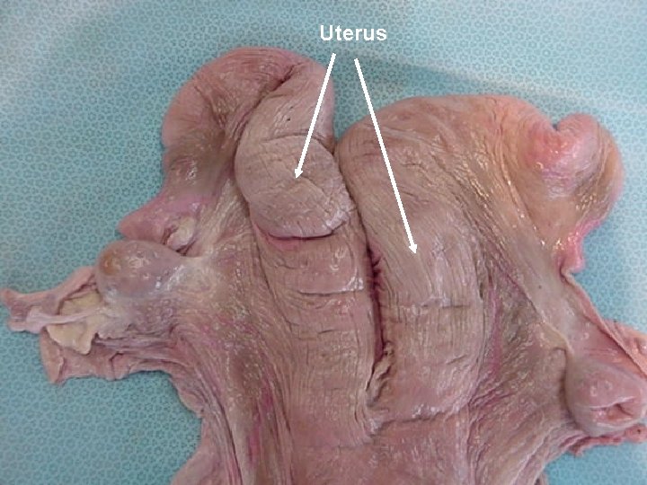 Uterus 