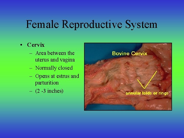 Female Reproductive System • Cervix – Area between the uterus and vagina – Normally