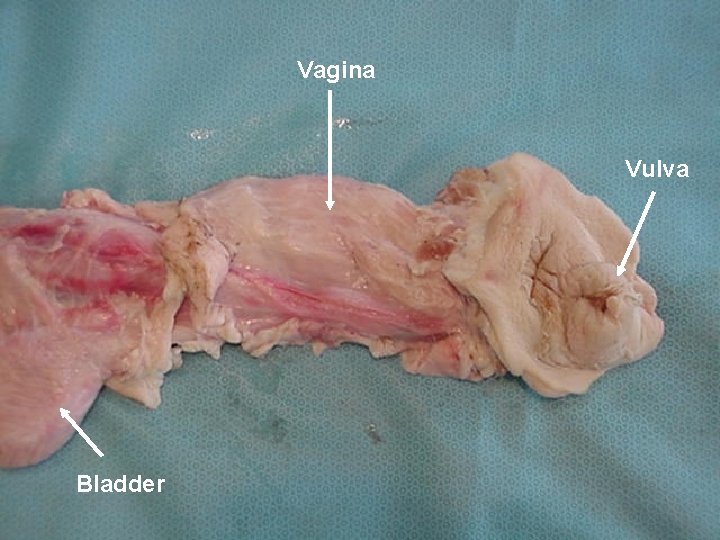 Vagina Vulva Bladder 