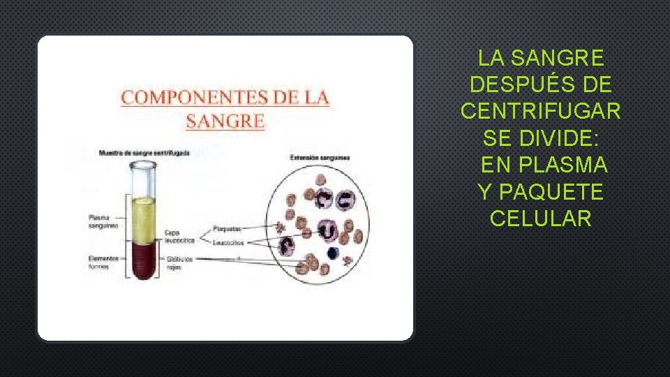 LA SANGRE DESPUÉS DE CENTRIFUGAR SE DIVIDE: EN PLASMA Y PAQUETE CELULAR 