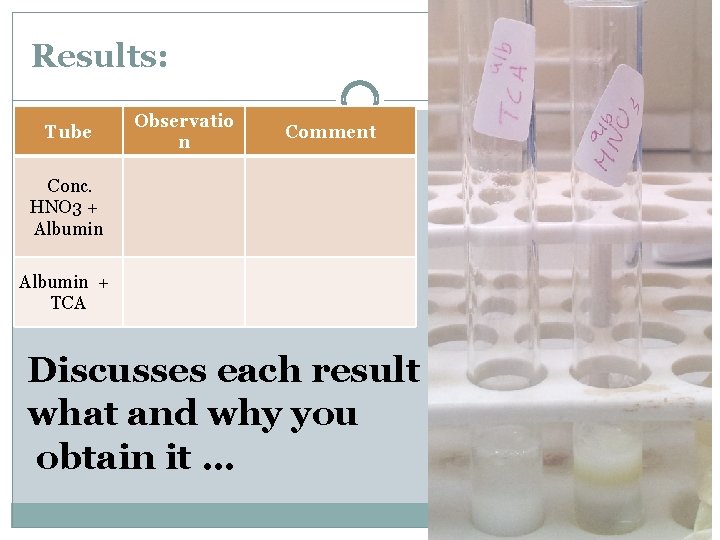 Results: Tube Observatio n Comment Conc. HNO 3 + Albumin + TCA Discusses each