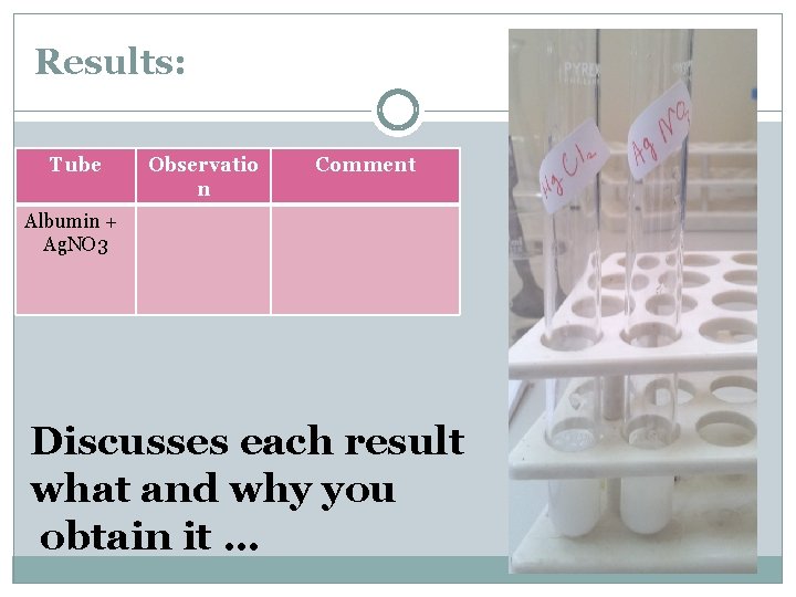 Results: Tube Observatio n Comment Albumin + Ag. NO 3 Discusses each result what