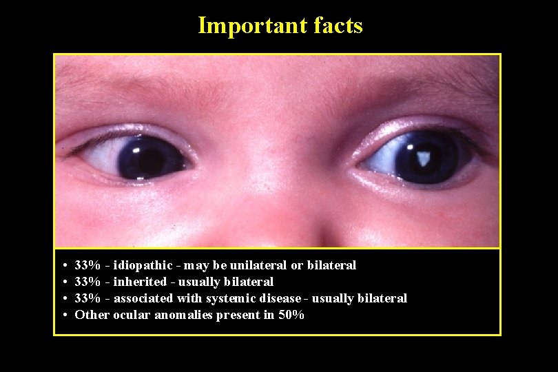Important facts • • 33% - idiopathic - may be unilateral or bilateral 33%
